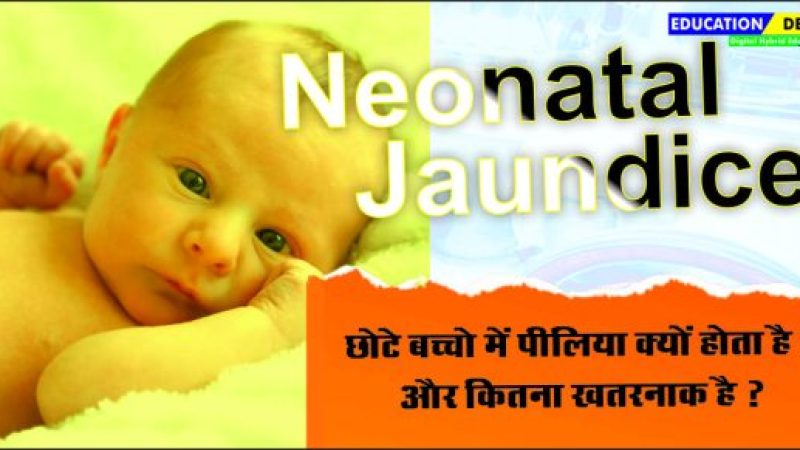 Neonatal Jaundice 2